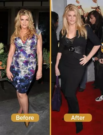 Before and after pictures of Kirstie Alley after losing weight