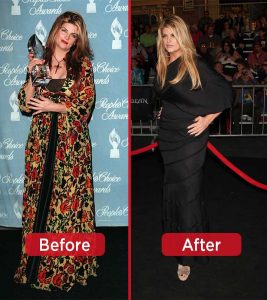 Kirstie Alley Weight Loss – Lose 50...