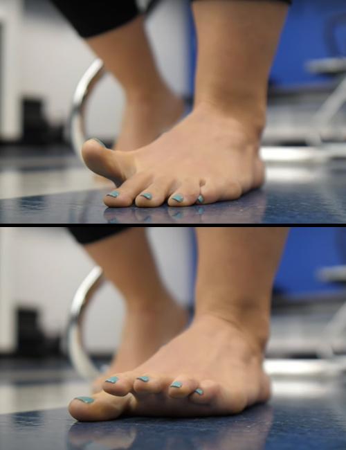 15 Plantar Fasciitis Exercises And Stretches To Relieve Foot Pain