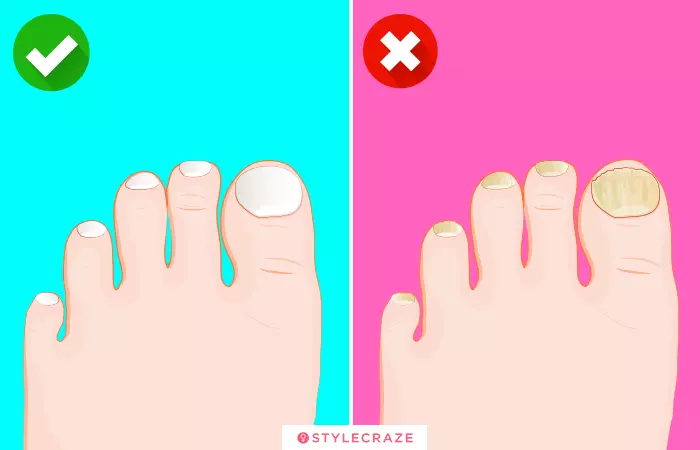 4. Colored Toenails