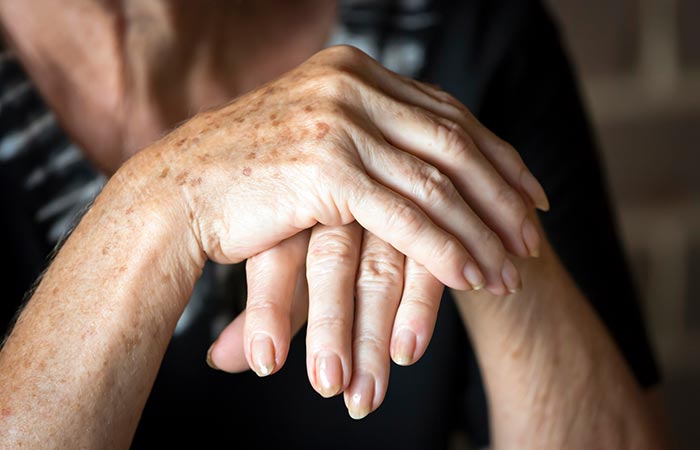 5. Psoriasis And Arthritis Signals