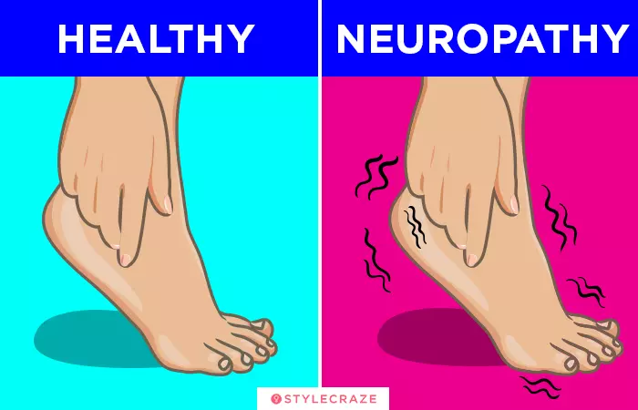 6. Numb Feet