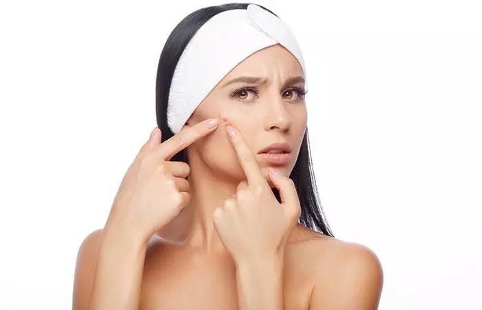 Can Treat Acne