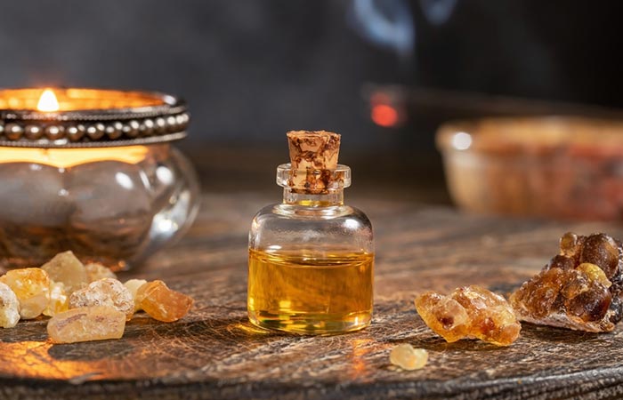 Frankincense oil as one of the remedies for ganglion cyst