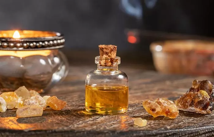 Frankincense oil as one of the remedies for ganglion cyst