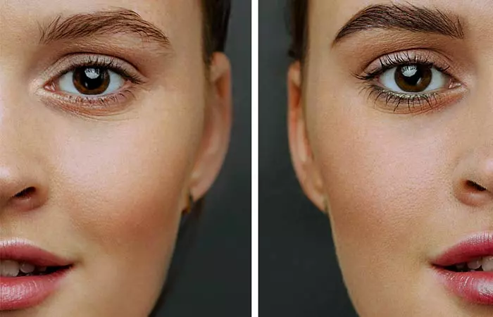 Having Mismatched Brows