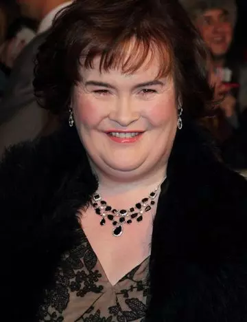 Susan Boyle before weight loss