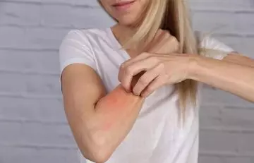 Irritated Skin On Arms 