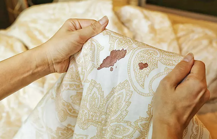  Stain Removal