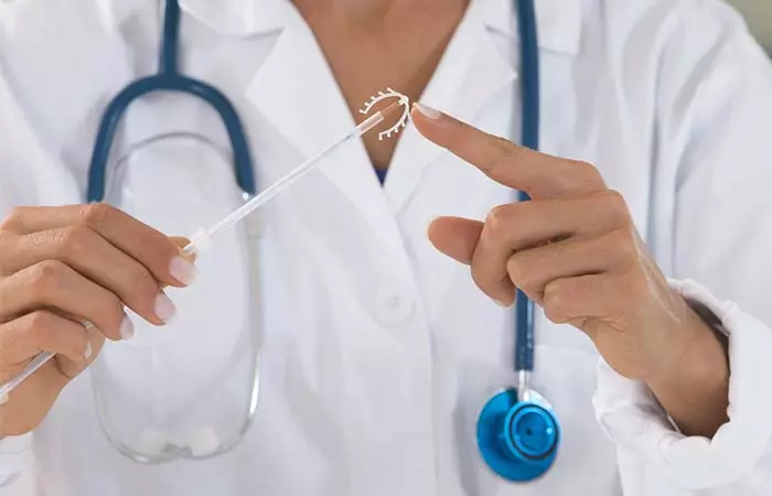 What Does A Copper IUD Do