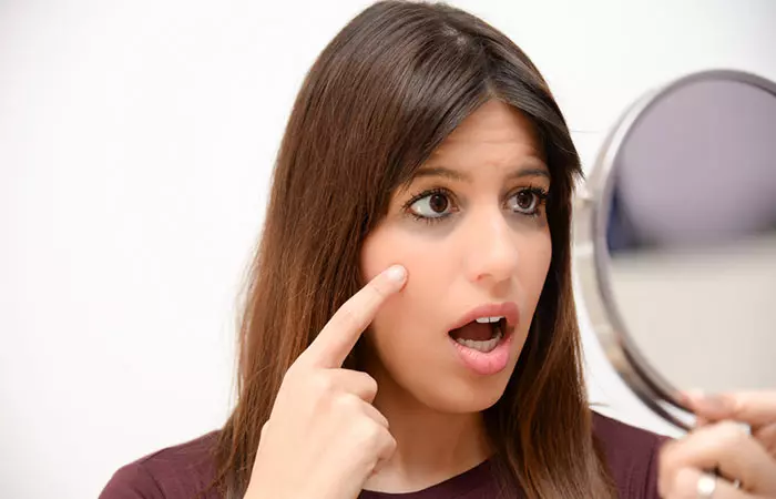 10. Dark Circles