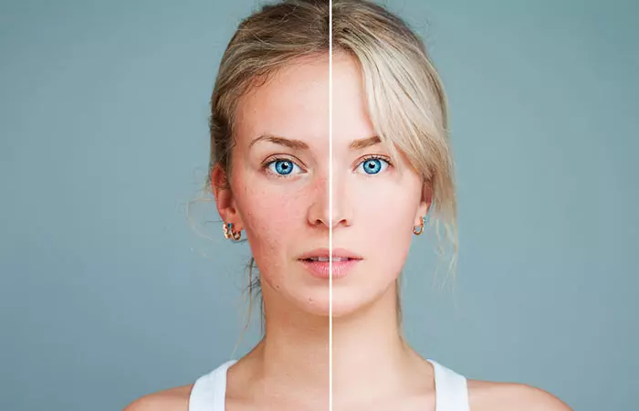 2. Skin Irritations