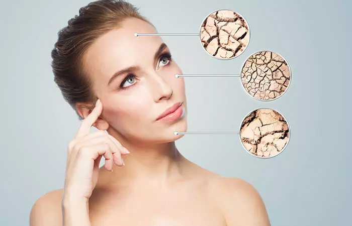 4. Skin Dryness