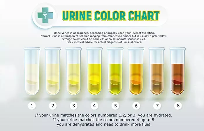 Change In Color Of Urine