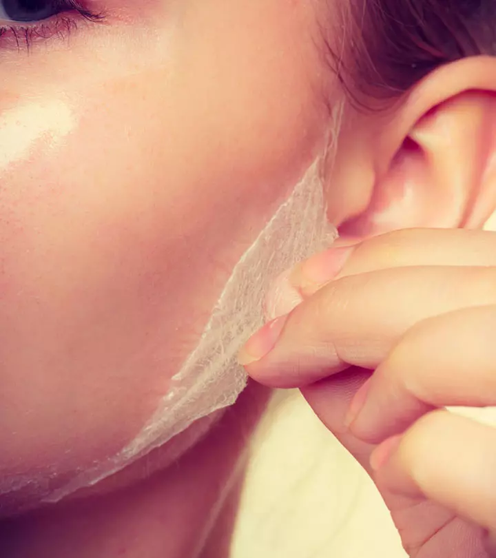 How To Do A Chemical Peel At Home – What You Need To Know A girl suffering from sunburn skin peeling