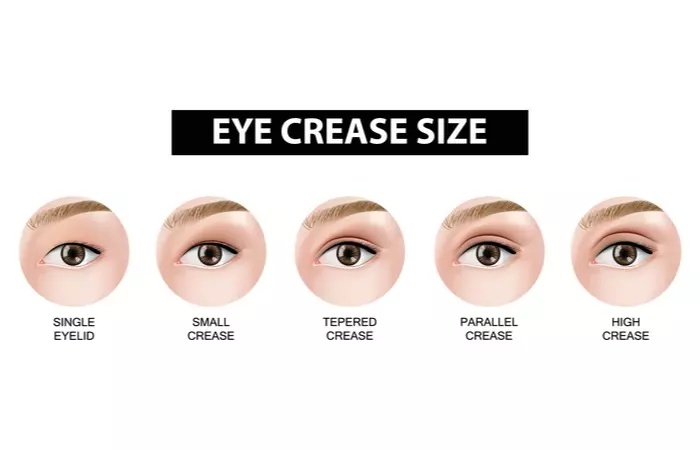 Eyelid crease type