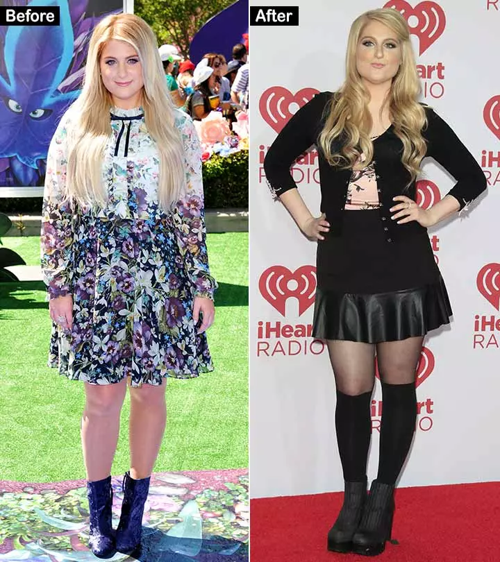 Meghan Trainor’s 20 Lbs Weight Loss – The Before And After Of The All About The Bass Singer