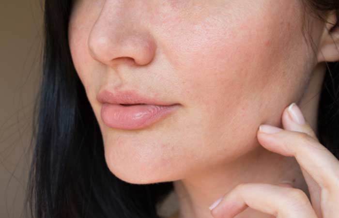 What Are The Causes Of Large Pores