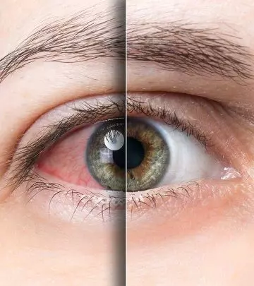 8 Exercises All People With Tired Eyes Need