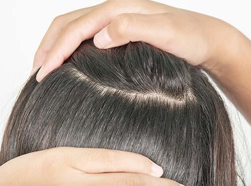 All You Need To Know About Coarse Hair