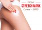 The 15 Best Stretch Mark Creams That ...