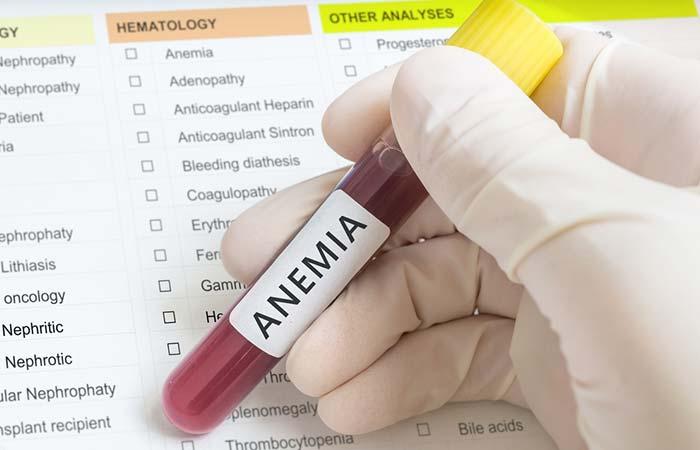 It’s Helpful In Treating Anemia