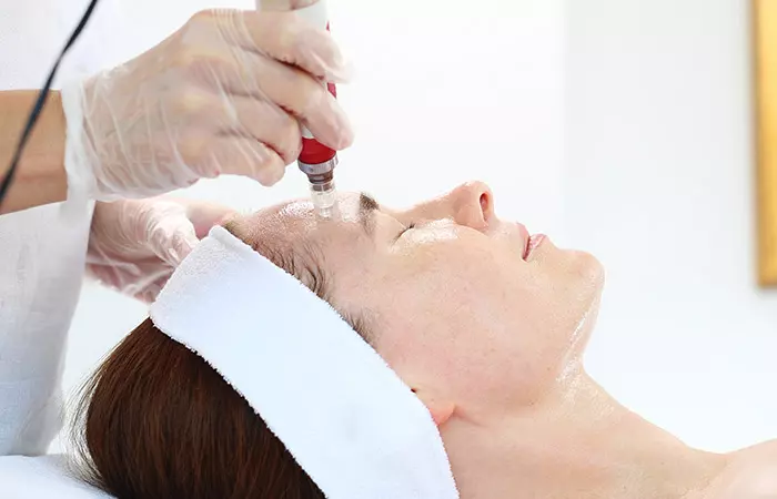 What is mesotherapy for face