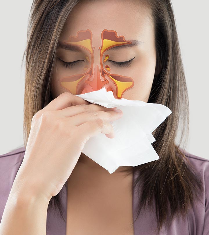 साइनस के लक्षण, कारण और घरेलू इलाज - Sinusitis Symptoms and ...