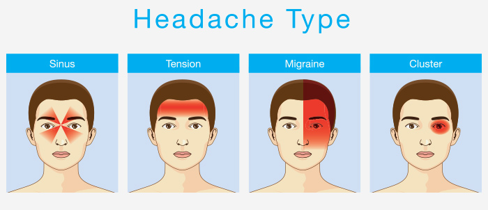 स र दर द क क रण लक षण इल ज और घर ल उपच र Home Remedies For Headache Sir Dard In Hindi