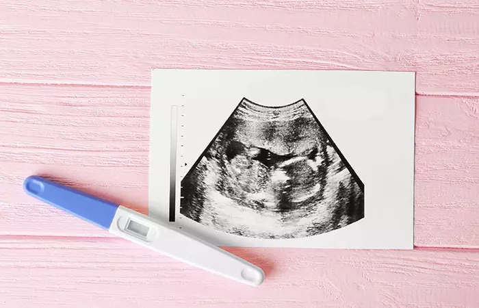 When The Earth Shifted