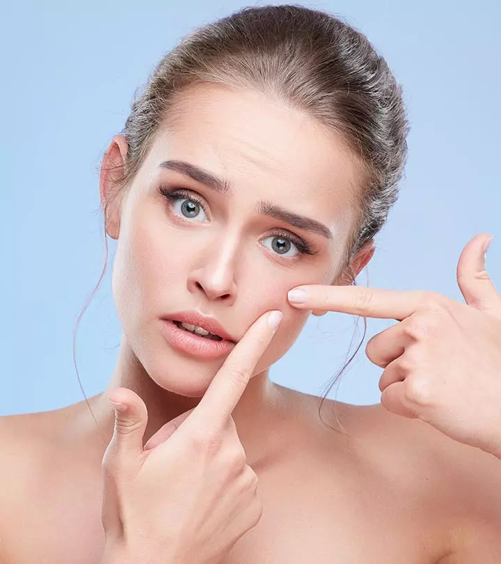 6 Ways You Should Not Treat A Pimple And 2 Ways You Should
