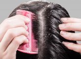 How To Get Rid Of Dandruff In Hindi - बालों से रूसी (डैंड्रफ) हटाने के उपाय