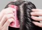 How To Get Rid Of Dandruff In Hindi - बालों से रूसी (डैंड्रफ) हटाने के उपाय