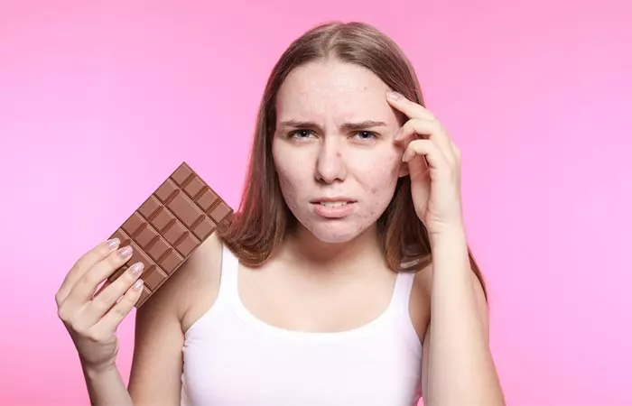 Don’t Indulge in Foods That Trigger Your Acne