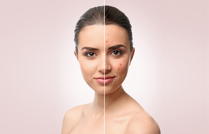 Before and after images of woman after using argan oil