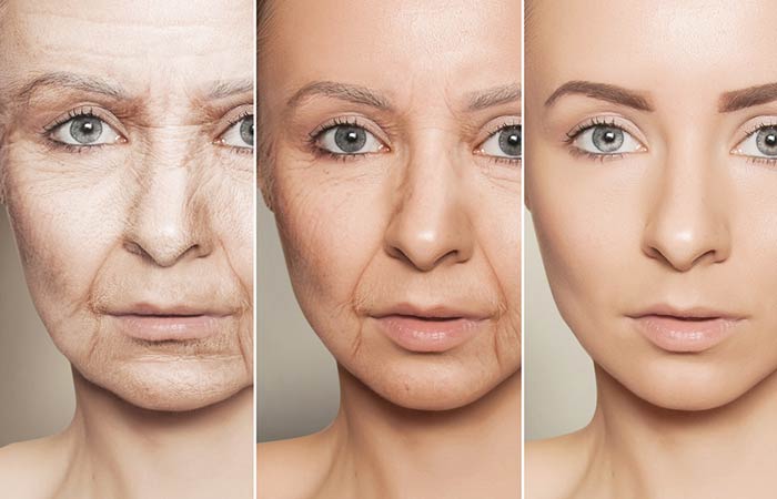 Sugar Can Make Your Skin Age Before Its Time