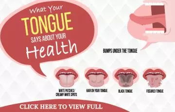 Types of Tongue tb