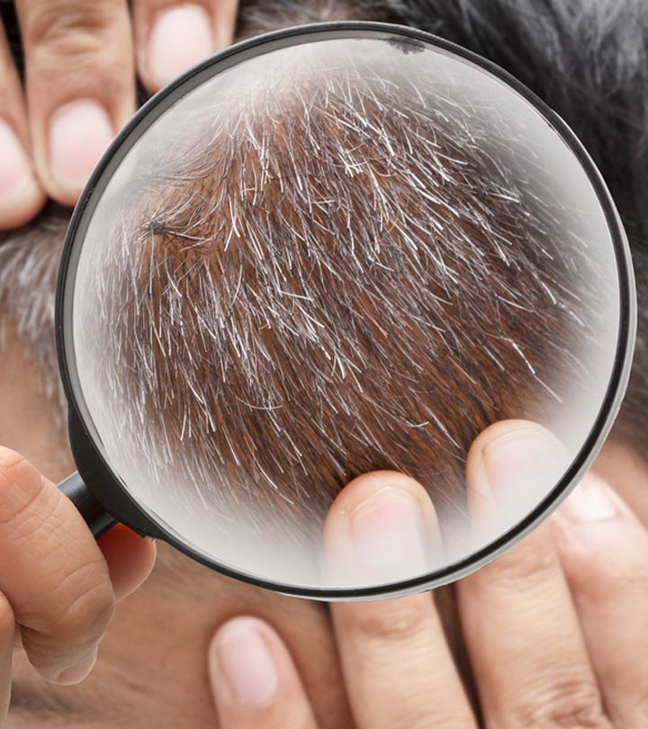 सफेद बालों से छुटकारा पाने के घरेलू इलाज – White Hair (Safed Baal) Treatment at Home in Hindi