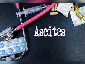 Ascites Home Remedies in Hindi