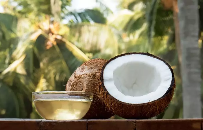 Coconut oil for shingles