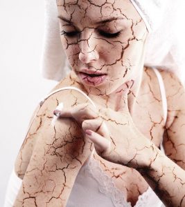 Dehydrated Skin: Causes, Symptoms, An...