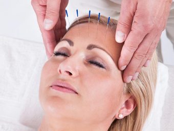 Facial Acupuncture What Is It, Benefits, And Side Effects