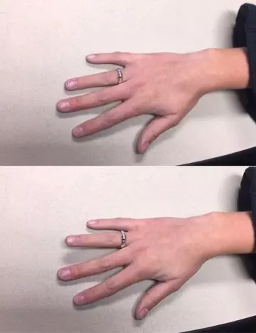 Flat-Hand Finger Lifts