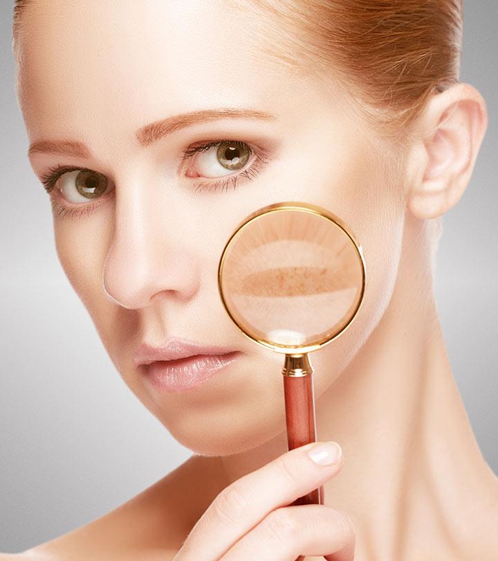 Home Remedies For Skin Pigmentation In Hindi