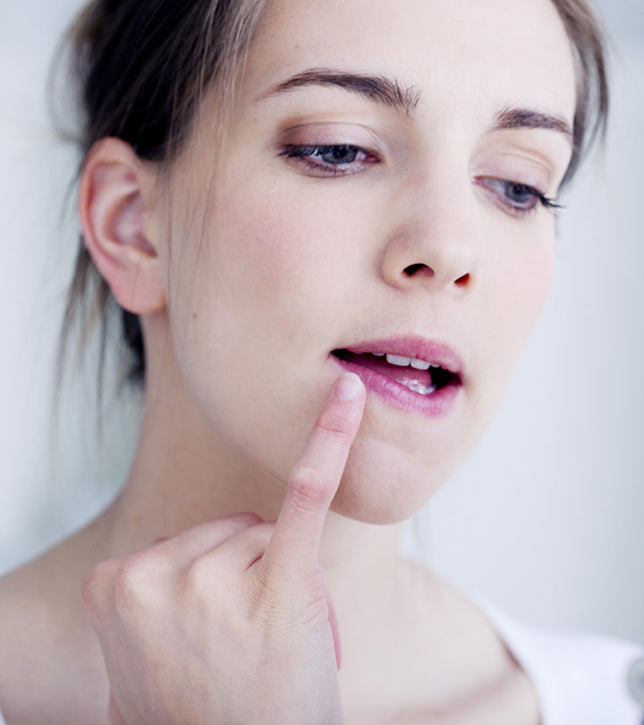 फटे होंठों के लिए 10 घरेलू उपाय – Home Remedies for Cracked Lips in Hindi