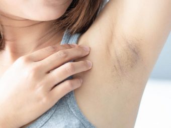 Home Remedies for Dark Underarms in Hindi