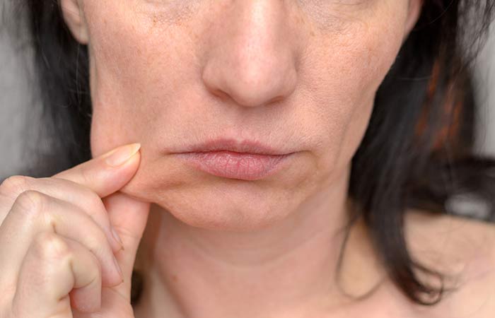 signs of dehydration on face