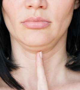 Remedies And Exercises To Get Rid Of Double Chin in Hindi
