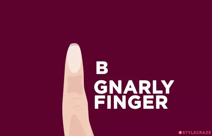 B