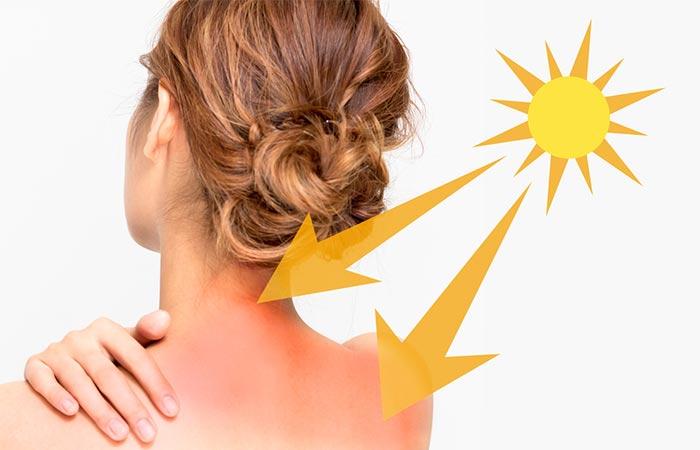 Soothes Sunburn